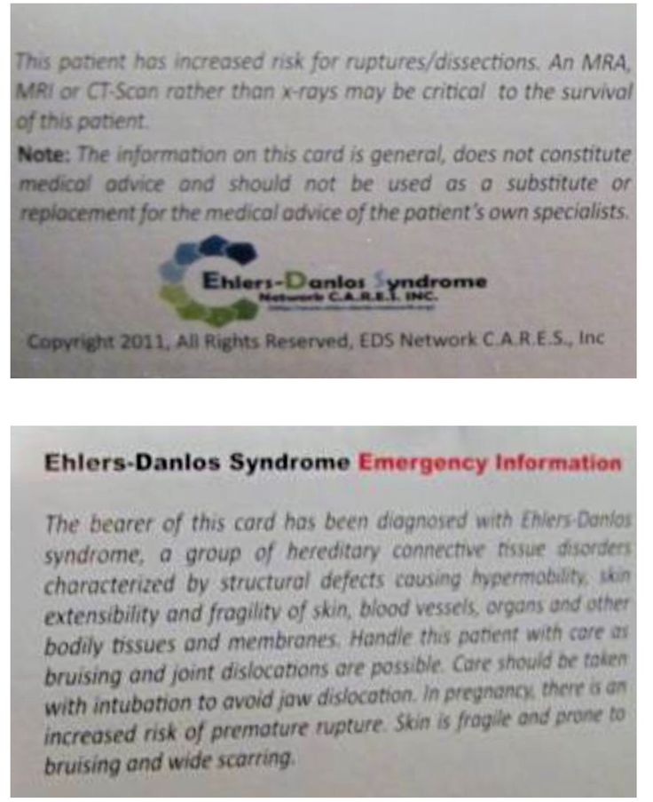 20 best Ehler danlos syndrome images on Pinterest Chronic - patient note 20 best Ehler danlos syndrome images on Pinterest Chronic - patient note