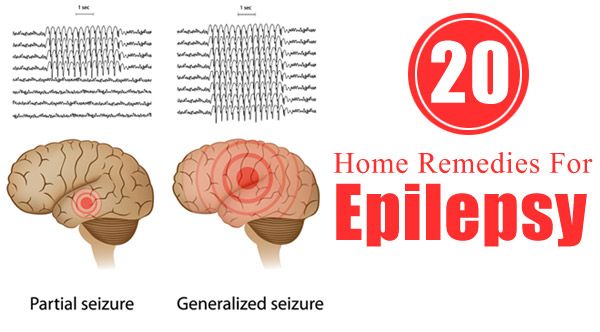 home remedies for seizures 64 best all about epilepsy images on epilepsy facts epilepsy quotes and home remedies for seizures 64 best all about epilepsy images on epilepsy facts epilepsy quotes and