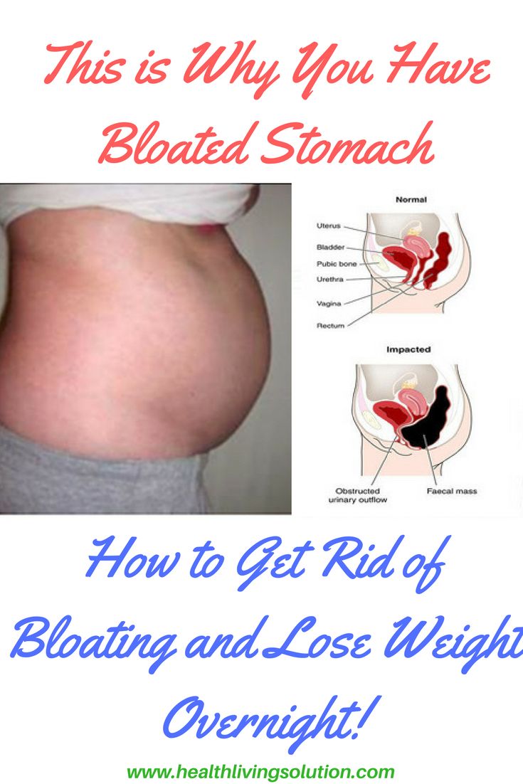 How Can I Get Rid Of Gas And Bloating Naturally How Can I Get Rid Of Gas And Bloating Naturally