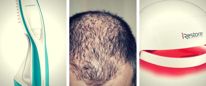 Professional Hair Regrowth Laser Comb Laser Hair Therapy Hair Growth Comb Laser Hair Treatment