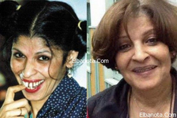شاهد صور عائشة الكيلاني بعد عمليات التجميل