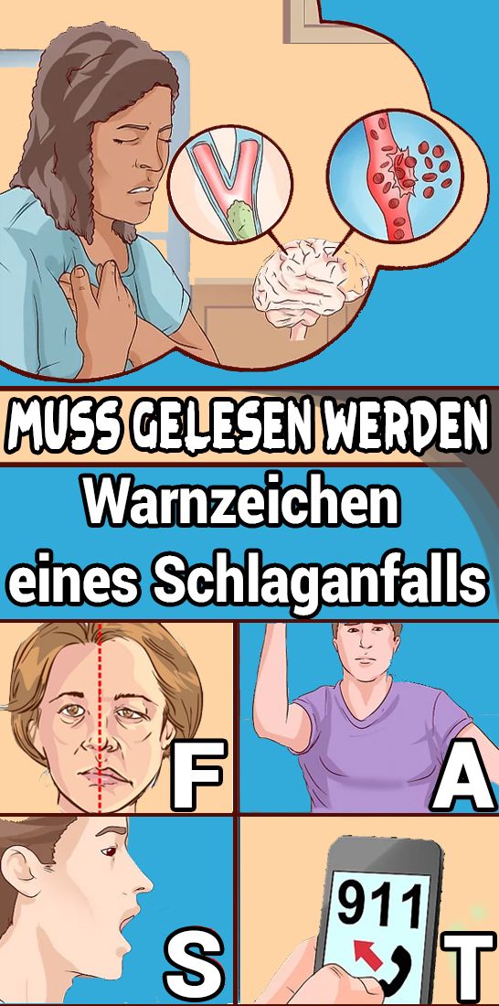 Muss gelesen werden: Warnzeichen eines Schlaganfalls – Körper & Geist Muss gelesen werden: Warnzeichen eines Schlaganfalls – Körper & Geist