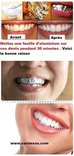 dent blanche aluminium dent blanche aluminium