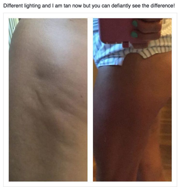Is lemon burn fat image 7