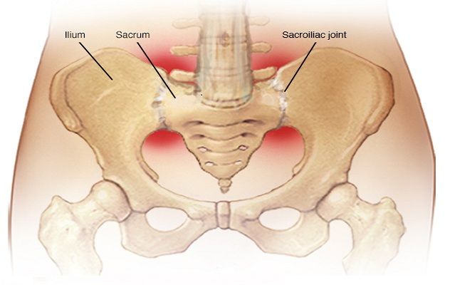 Natural Treatment Si Joint Pain Natural Treatment Si Joint Pain