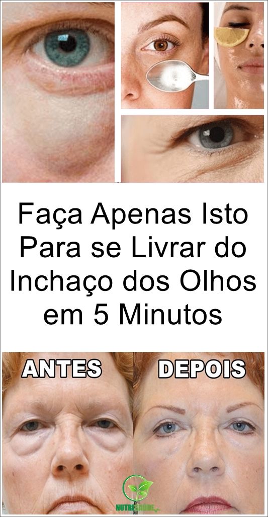 Nos inchaço tratamentos olhos de
