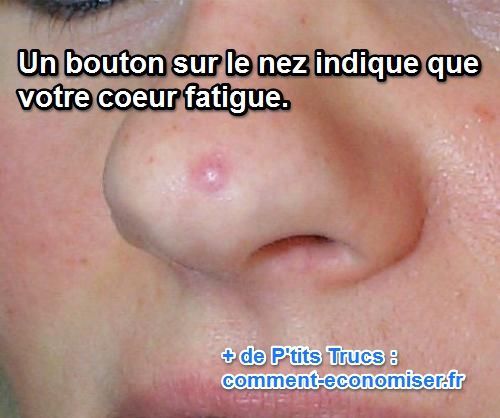 Les 25 meilleures idées de la catégorie Boutons sur le Les 25 meilleures idées de la catégorie Boutons sur le