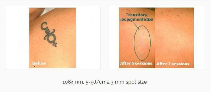 Visit Skin Deep Laser Services Official Website to enhance your information abou...