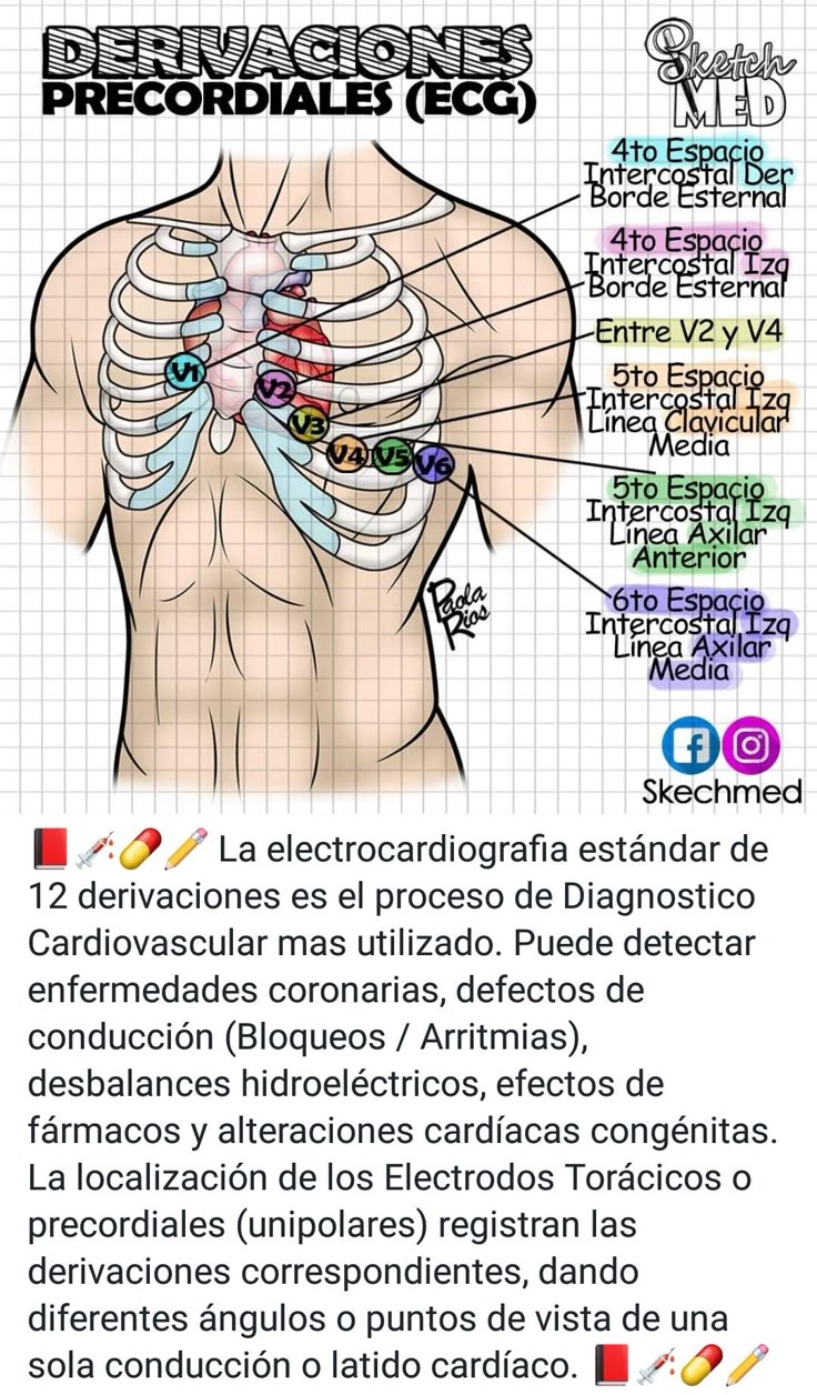 Electrocardiografía