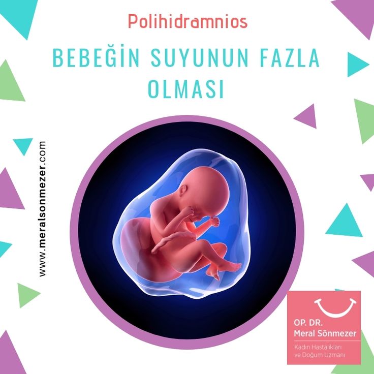polihidroamniyos nedir bebeginin icerisinde bulundugu amniyon sivisinin normalden daha fazla olmasina polihidroamnios denir gebeliklerin yaklasik 1 2 simsek