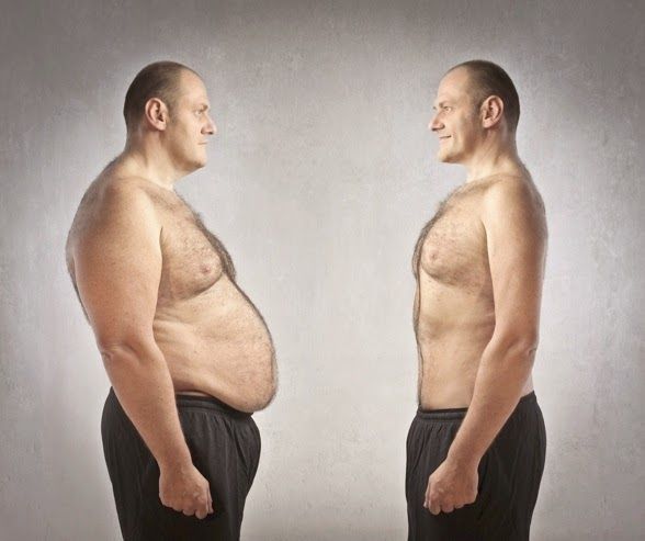 Weight loss doctors in rochester new york image 10