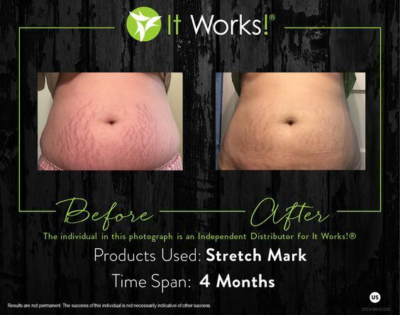 8 best it works stretch marks results images on pinterest stretch stretch works