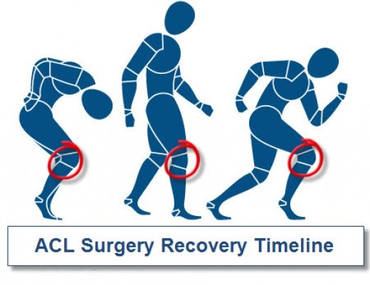 my acl reconstruction recovery and some tips for dealing with post