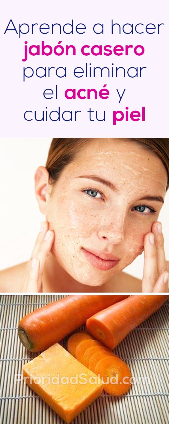 Aceite de oliva para eliminar el acne