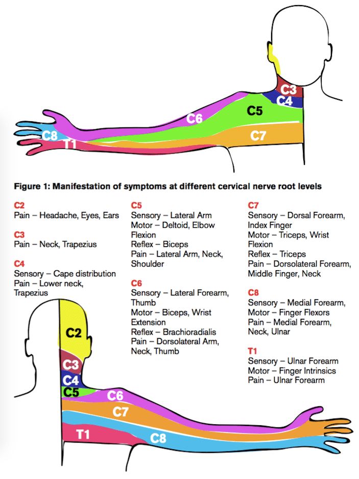Pin On Neuromuscular pin-on-neuromuscular