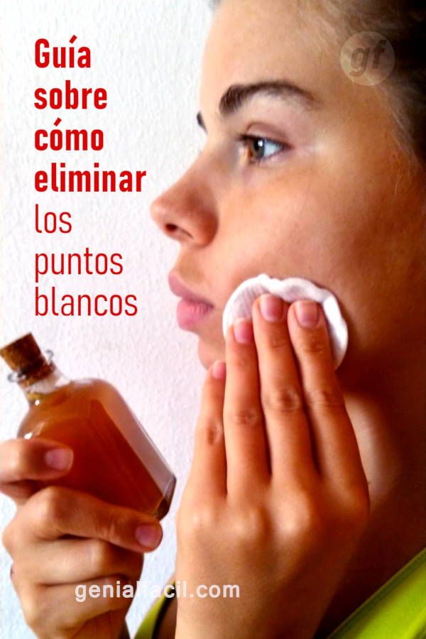Qué Son Los Puntos Blancos Bueno Son Las Cosas Más Molestas Del Mundo Tipo De Protuberancias Que Aparecen En El Momento Comedonal Acne Whiteheads Face Care