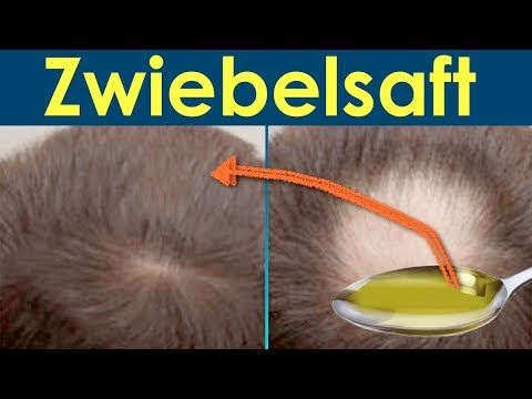 Zwiebelsaft für Haarnachwuchs für davor und danach/ Zwiebelsaft für und H...