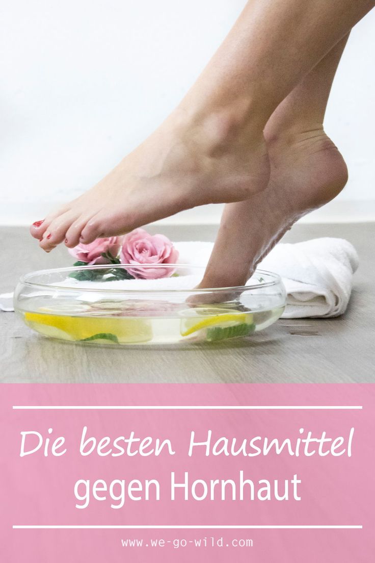 Hornhaut Richtig Entfernen Hornhaut Richtig Entfernen
