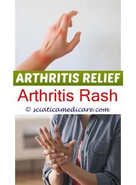 osteoarthritis arthritis gloves to help arthritis - rheumatoid arthritis nodules...