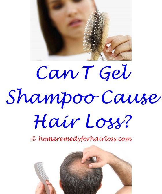 17 best Hair Loss Pills images on Pinterest | Beer bottle, Co ...