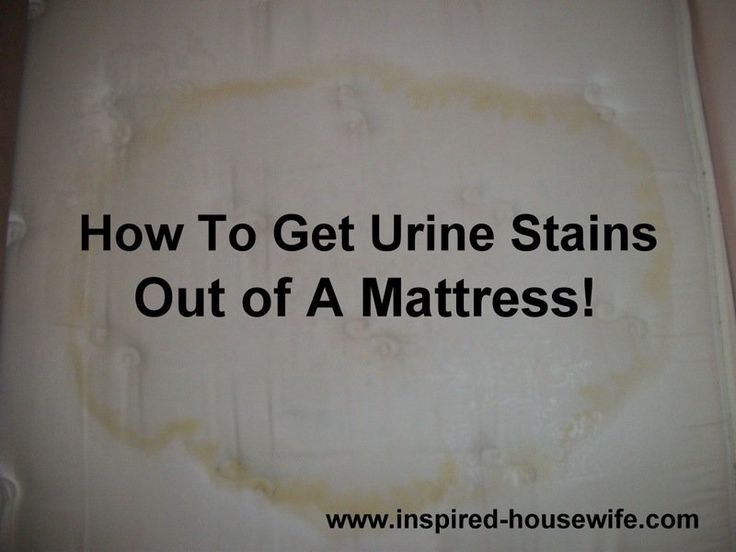 Best 25 Mattress Stain Removers Ideas That You Will Like On How To Get Stains Out Of A Mattress