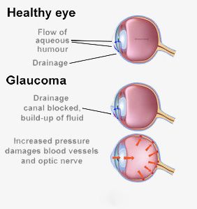 Symptoms Of High Eye Pressure In Dogs Symptoms Of High Eye Pressure In Dogs
