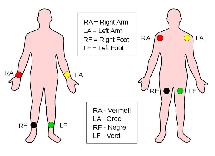 limb leads med school student life cardiac nursing medical assistant skills test