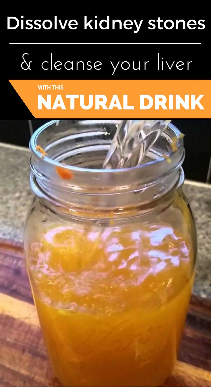 Natural Herbs To Dissolve Kidney Stones Natural Herbs To Dissolve Kidney Stones