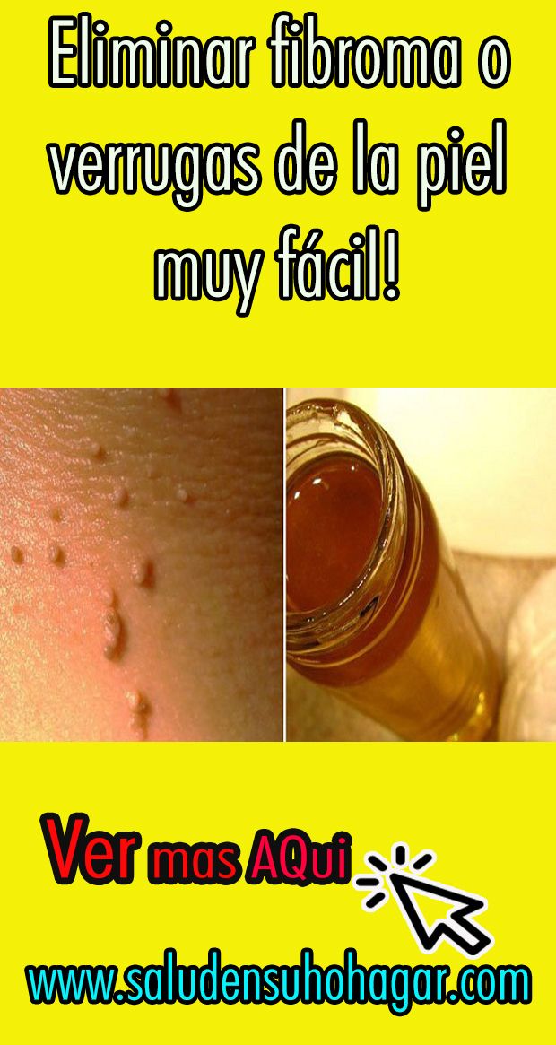 tamaño del virus del vph