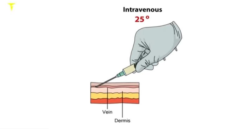 Pin By Raviikumar Ss18 On Medical Medical plasma-serum