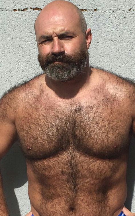 bald, yet hairy Bald, yet hairy