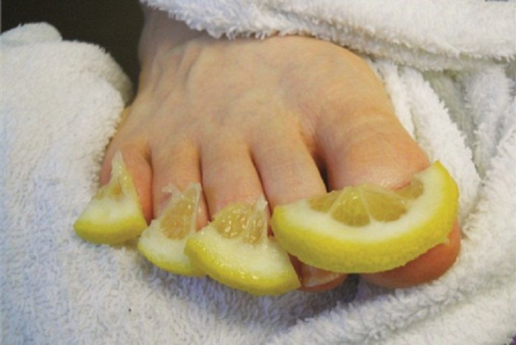 Natural Oral Treatment For Toenail Fungus Natural Oral Treatment For Toenail Fungus