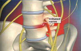 nerve study on back nerve study on back