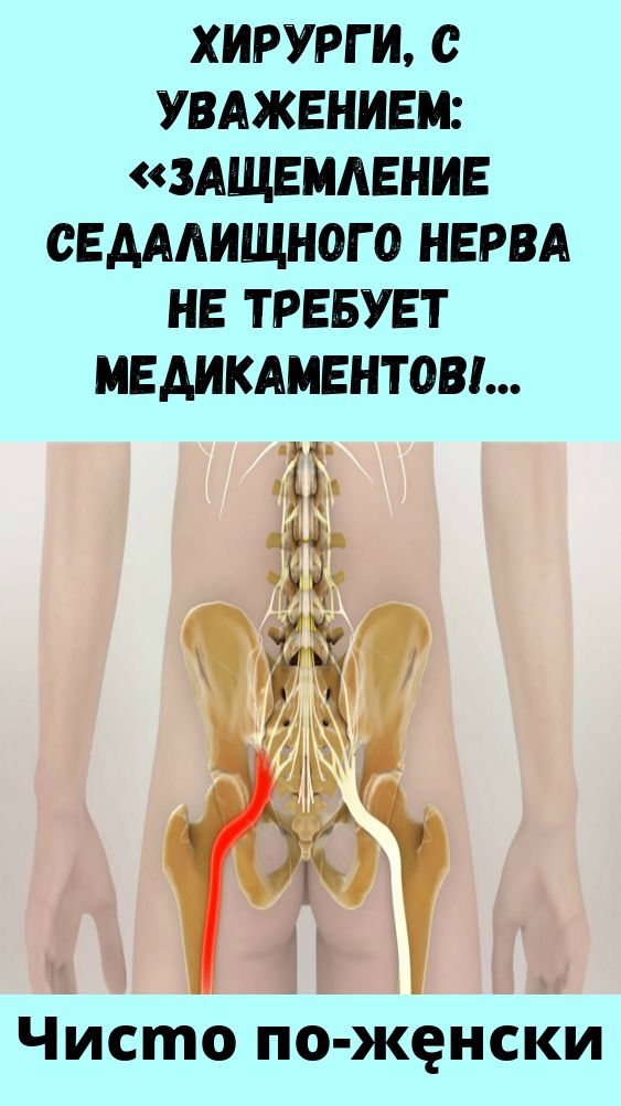 A Visual Guide to Sciatica Sciatica, Sciatic nerve pain, Sciatica cure