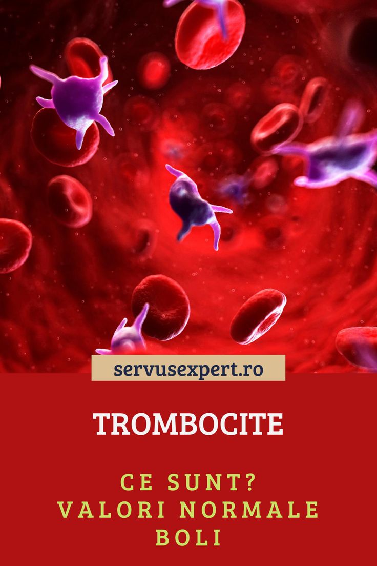 varicoza i trombocite scazute