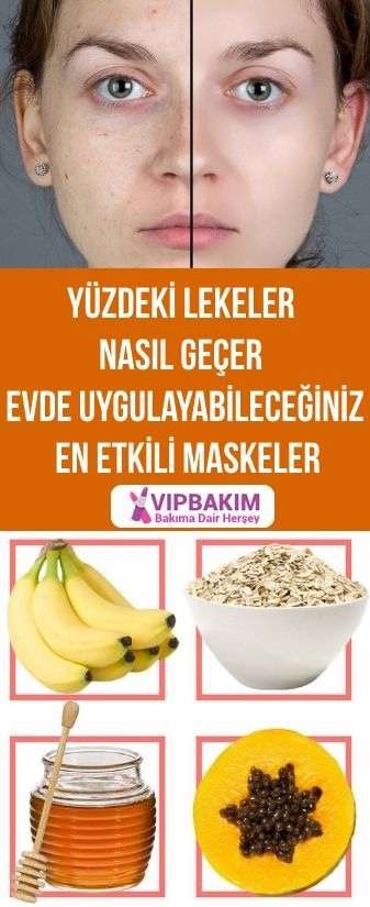 Yuzdeki Lekeler Nasil Gecer Evde Uygulayabileceginiz Dogal Cozumler Vipbakim Dogal Yuzler Ev Yapimi Cilt Bakimi