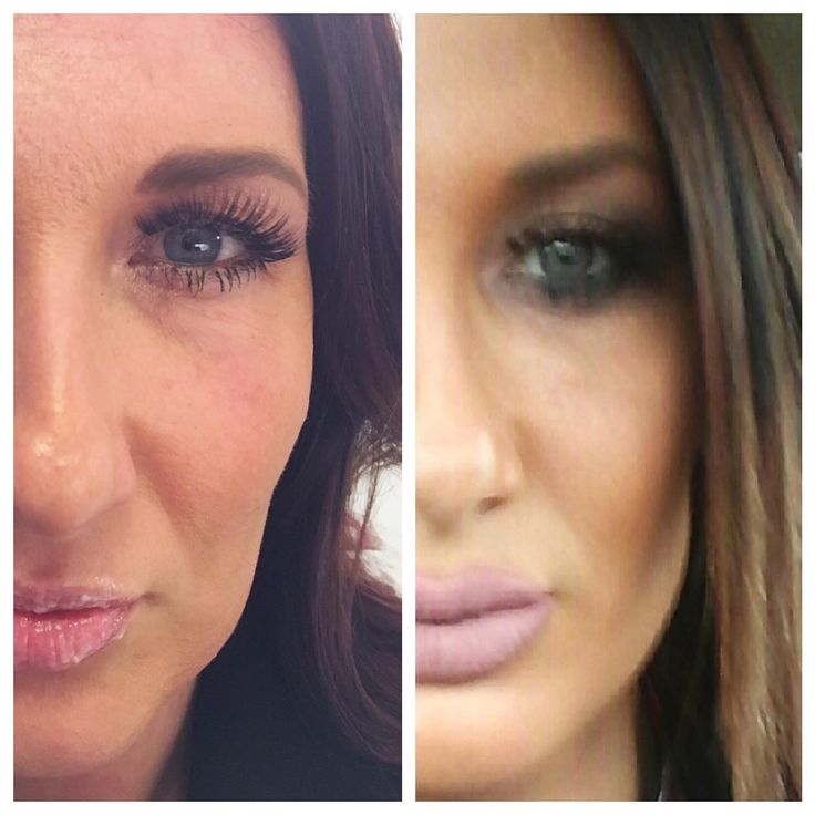 Tutorial eye makeup older women at home Bad botox before and after 0 4
