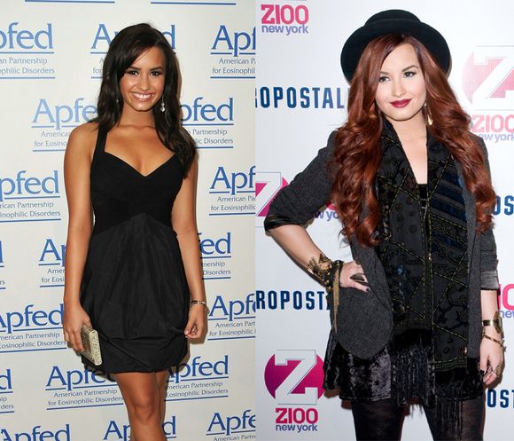 salsa weight loss surgery salsa weight loss surgery