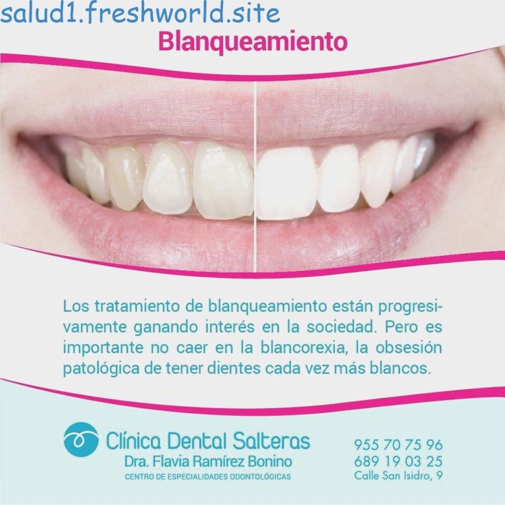 blanqueamiento dental casero odontología