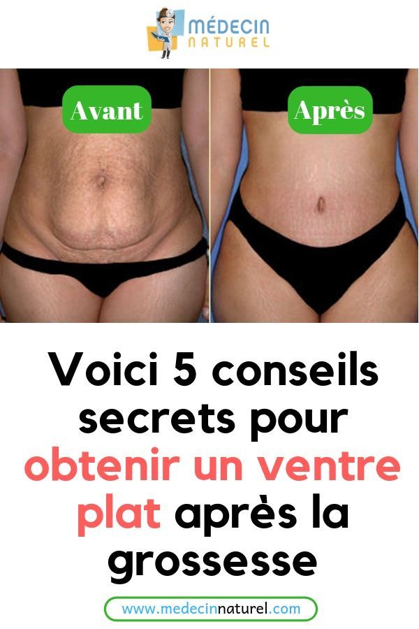 comment maigrir vite apres un accouchement