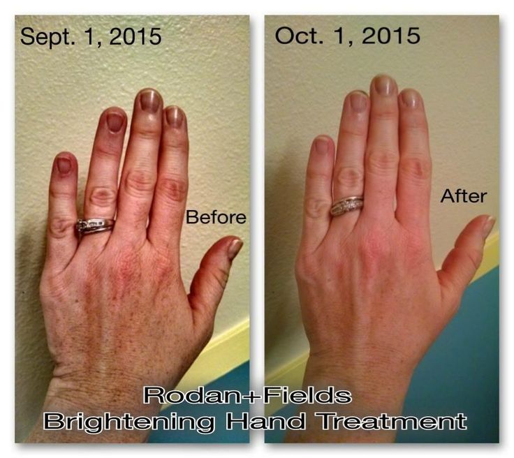 Natural Hand Moisturizer For Dry Skin Natural Hand Moisturizer For Dry Skin