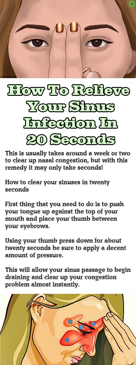 How To Relieve Your Sinus Infection In 20 Seconds | Sinusitis, Sinus