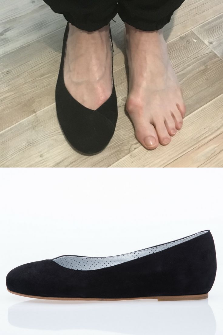 Best Dress Shoes For Bunions And Arch Support Best Dress Shoes For Bunions And Arch Support