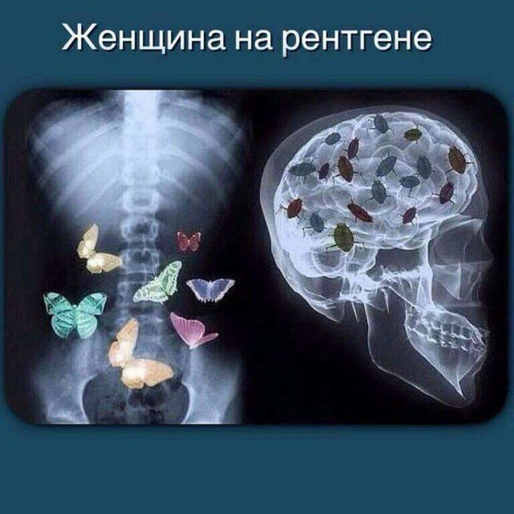 Про, бабочки в животе смешные картинки