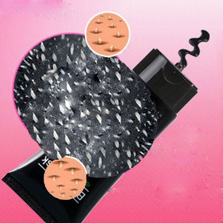 Amazing Blackhead Removal Cleansing Facial Mask It's Wonderful This is the b...