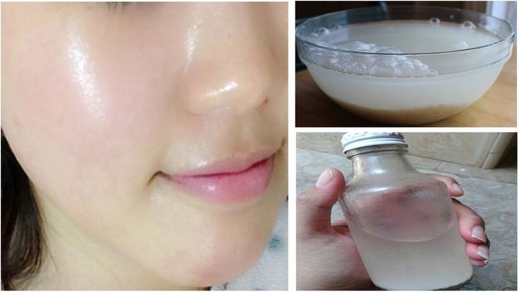 Pin on Skin Whitening Cream Pin on Skin Whitening Cream