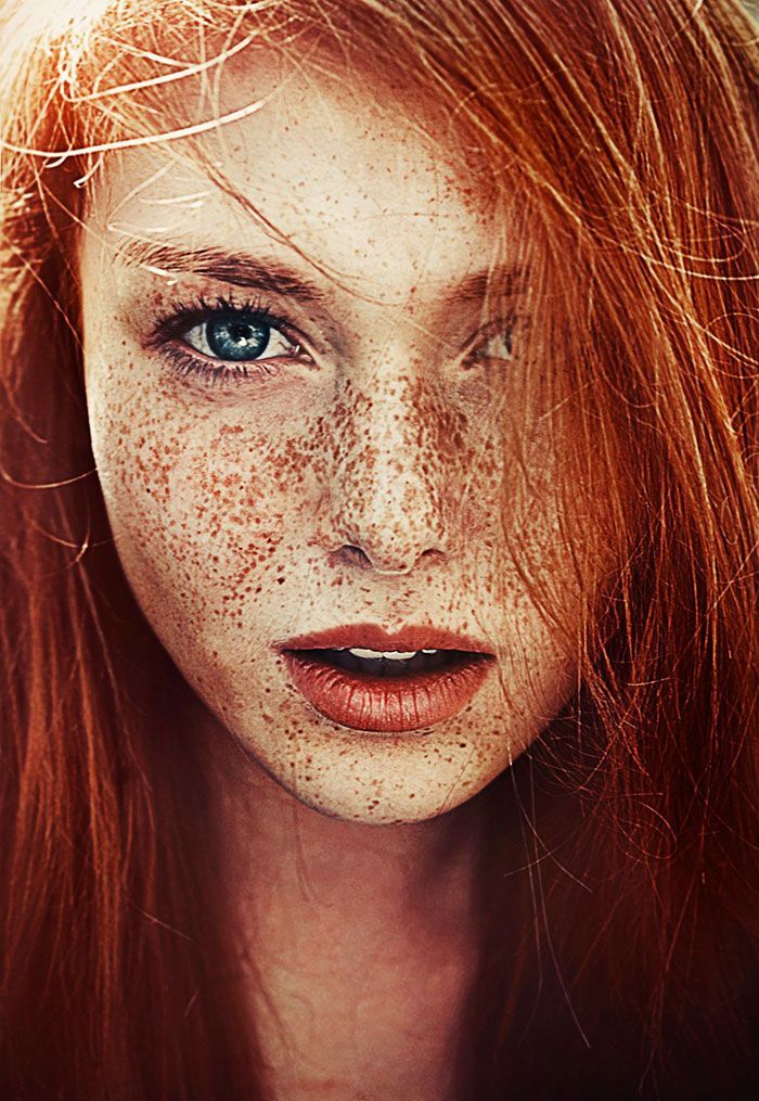 98 Freckled People Wholl Hypnotize You With Their Unique Beauty