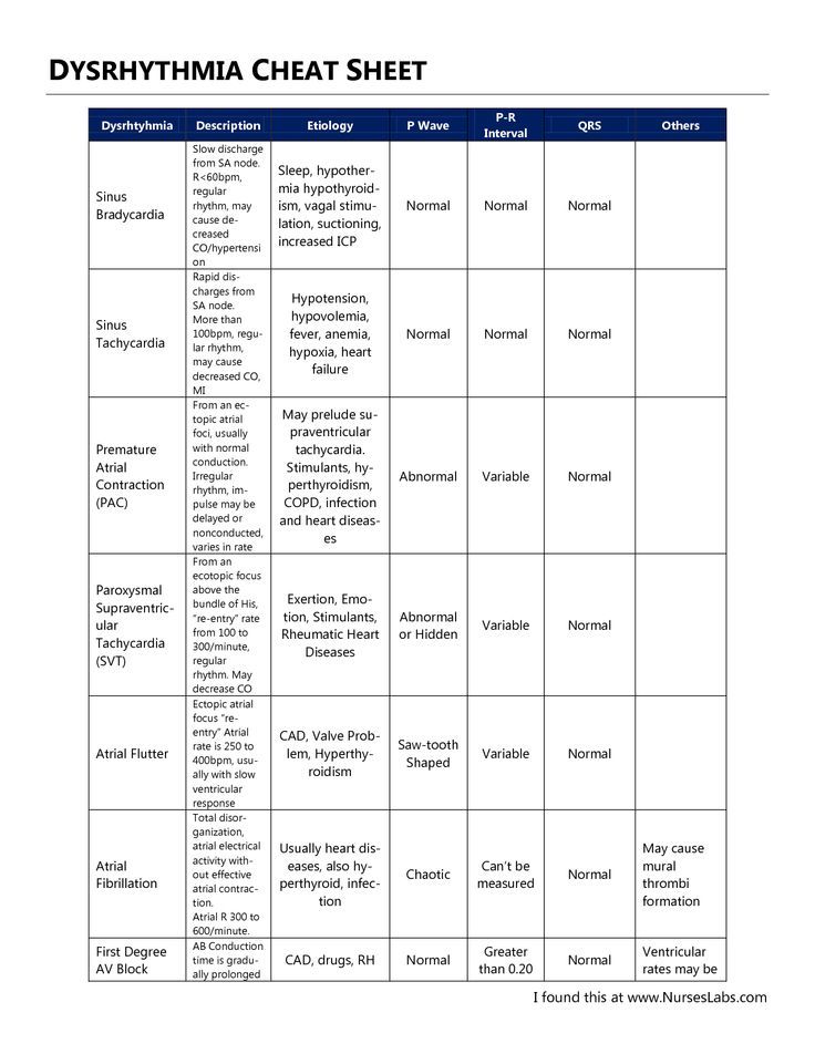 68 best Cardiac Nursing images on Pinterest Nursing schools