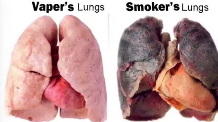 Quitting Lung Detox 63 best quit images on electronic Quitting Lung Detox 63 best quit images on electronic