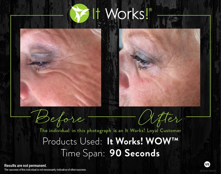 438 best it works results images on pinterest works global it see it works